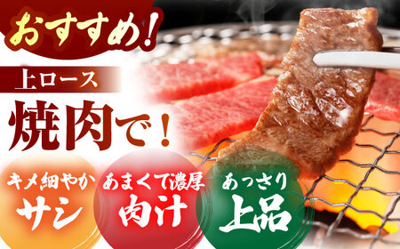 佐賀牛 ロース 盛り合わせ400g HCS100 ロース 和牛 牛肉