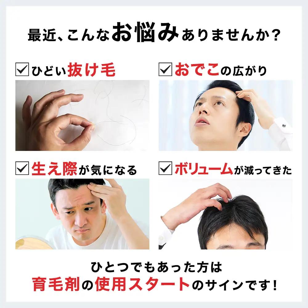 スーパーサイヤ 薬用 育毛剤 120ml×12本 男性用 女性用 育毛 ※沖縄・離島配送不可 