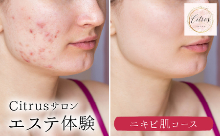 ニキビ肌コース（陶肌トリートメント＋ビタミンC〈VCF〉） 240P8003