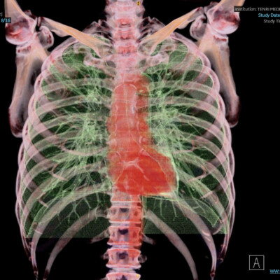 【ふるさと納税】天理発 3D CT ( 頚部 ～ 骨盤 )+胆・肝・膵 MRI 健診【1737495】
