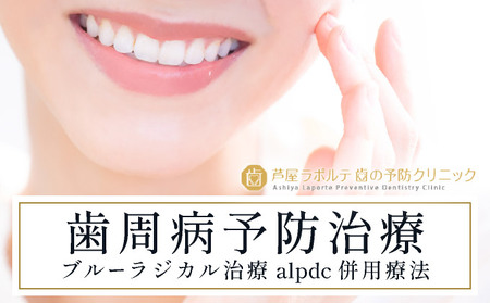 歯周病予防治療、ブルーラジカルP-01治療とalpdc併用療法（歯周病からの寛解）｜口腔ケア 歯 健康 歯周病 オーラルケア 歯医者 マウスウォッシュ 歯科治療 歯科 ラポルテ 芦屋市 歯の予防 080-a003