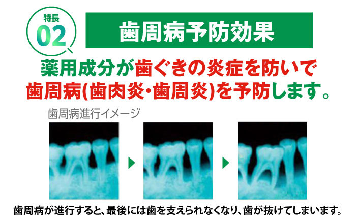 【歯周病と口臭を予防】毎日のケアでお口の健康をサポート