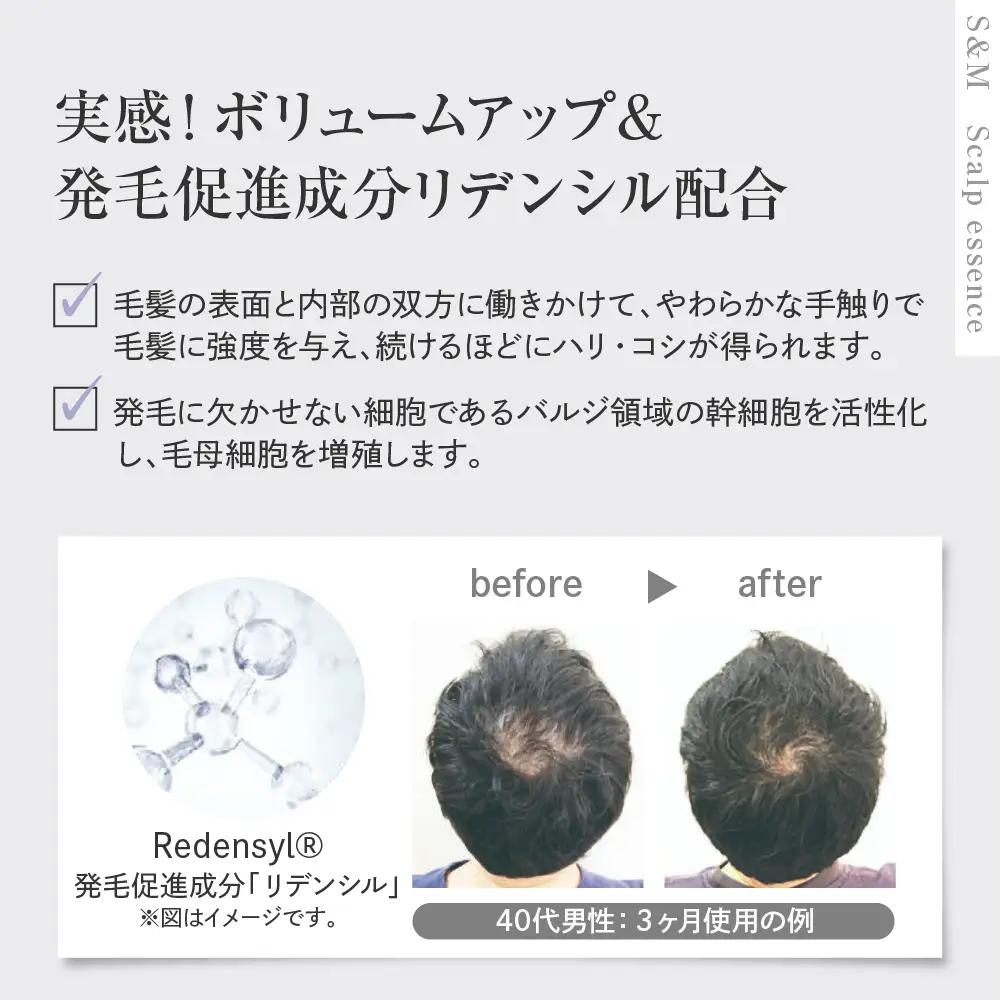 SAN＆MONI スキャルプエッセンス 300ml ※沖縄・離島配送不可 