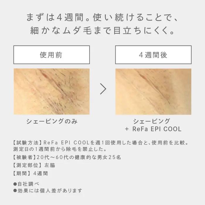 ReFa EPI COOL | リファ エピ クール 光美容器 ムダ毛ケア 家電 美容家電 ボディケア 美肌