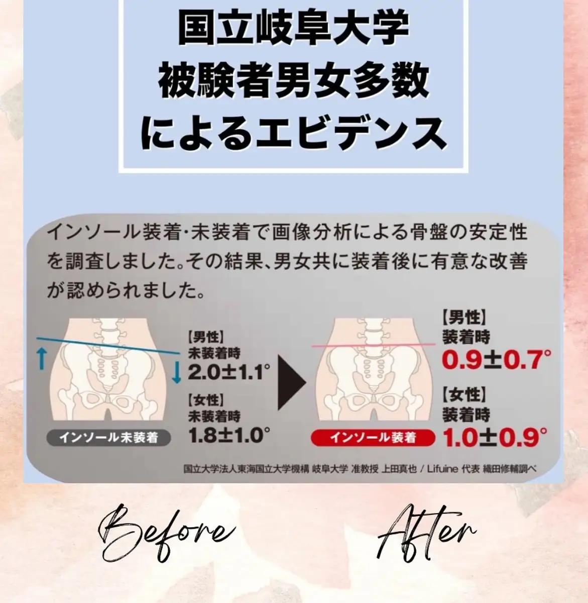 ５本指インソール ブラック XXL (湯煎用 トレー付き)