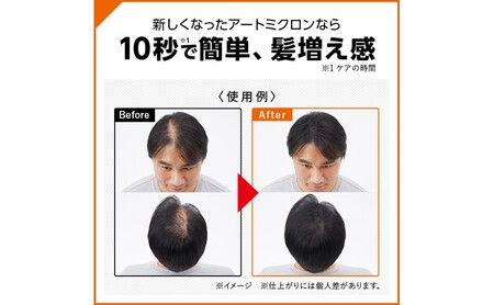 増毛 アートミクロン パウダー 20g ブラック 髪 つむじ ボリュームアップ 頭皮 ヘアスタイル ヘア 薄毛 白髪