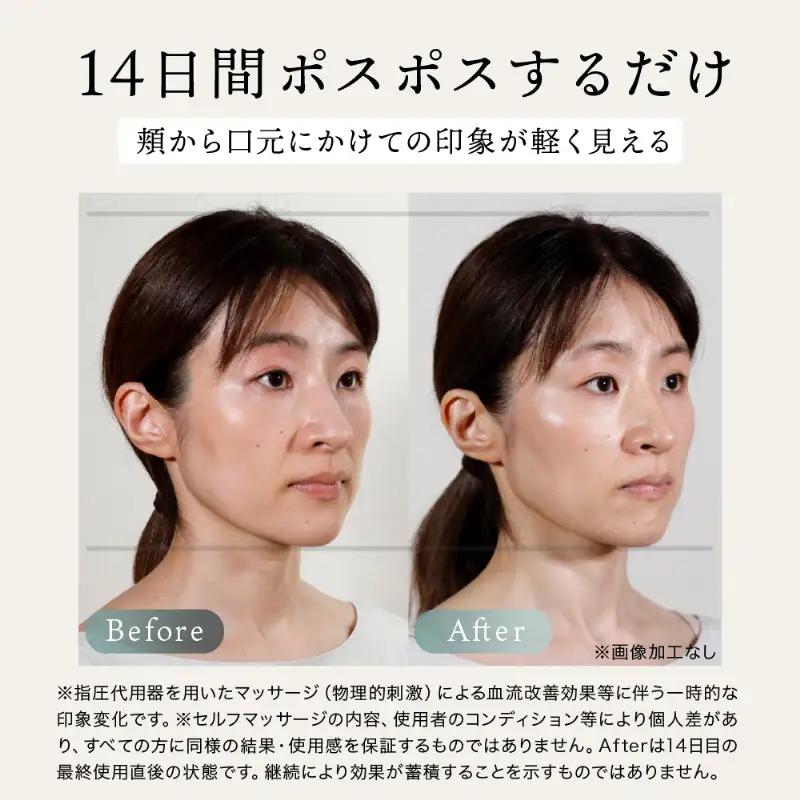 美顔器 FACE POiNTER 美顔器