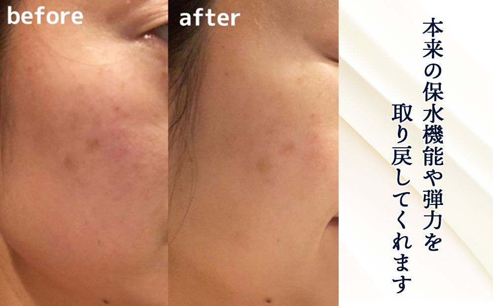 【定期便・全3回】北海道白老産 生プラセンタ美容液 〜アヨロのピリカ〜 AN005_イメージ2