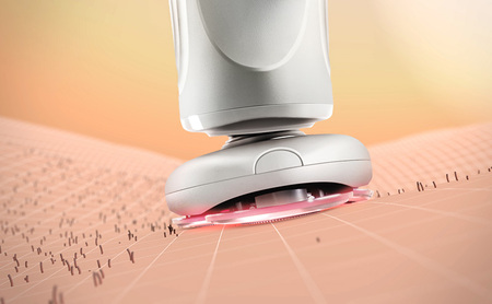ヤーマン 温剃り シェーバー ホットシェイブ スキンプロ HOTSHAVE SkinPro YJEC1W YA-MAN スキンケア フェイシャル LED 電気シェーバー 髭剃り 電動髭剃り 美容家電 