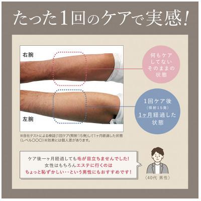 ふるさと納税 つくばみらい市 LINKA リンカ エピゼロ IPL光脱毛器 |  | 02