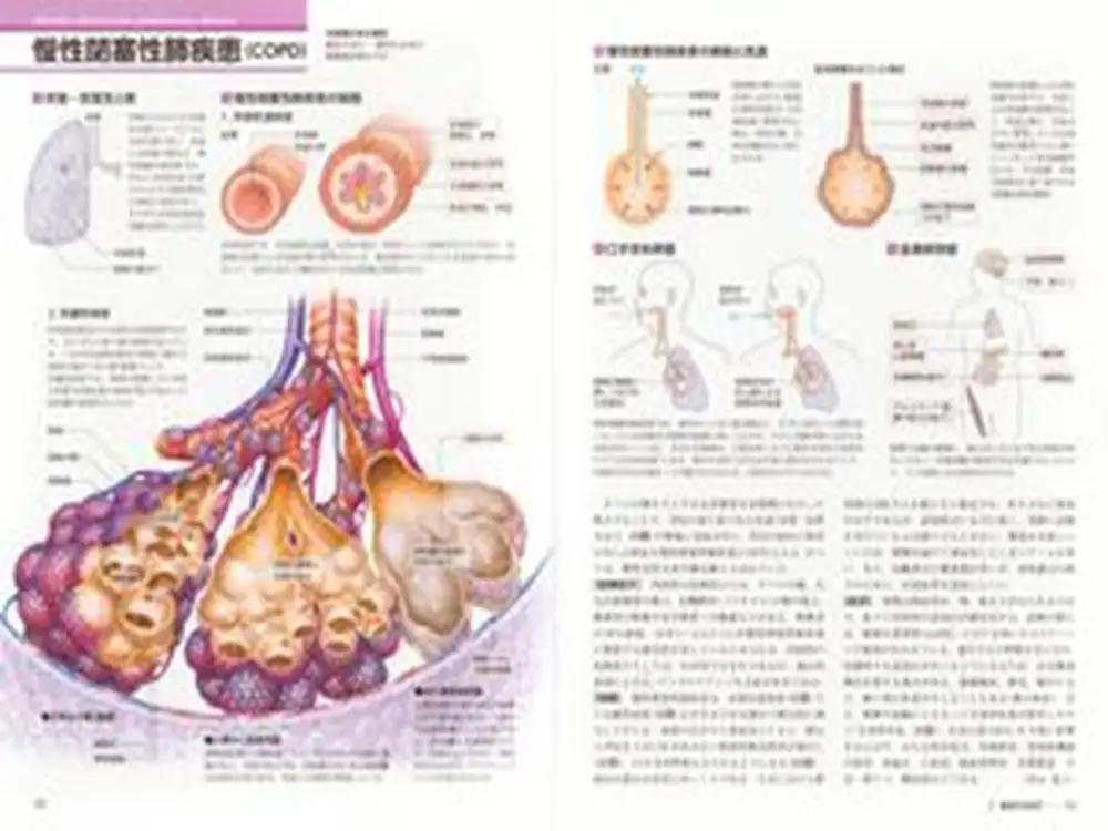 本 病気の地図帳 増補改訂版 本