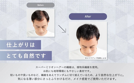 髪スーパーミリオンヘアー(増毛パウダー）1本（20g）No.1ブラック｜髪 髪 髪 髪 髪 髪