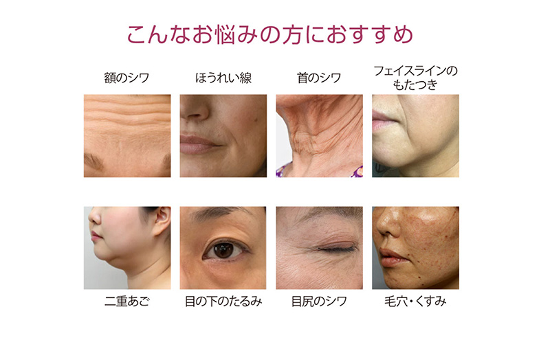 ラジオフォトレーション ミニキュアエクセレント(R) 美容 美肌 トリートメント フェイスケア ポイントケア