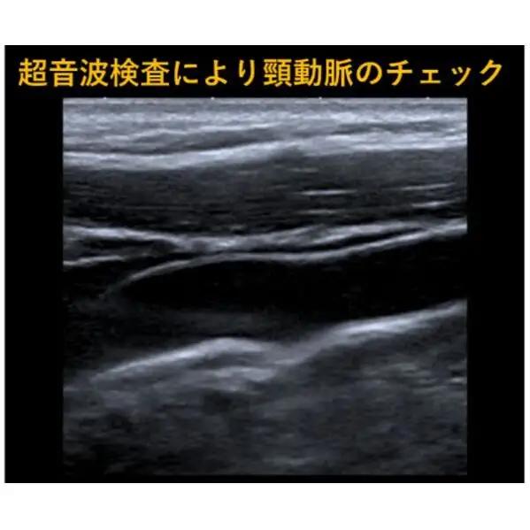 簡易脳ドック受診券1名分 脳ドック 利用 クーポン券 健康診断 チケット 人間ドック 浜松PET診断センター 検診 MR検査 超音波検査 血液検査 静岡 浜松市