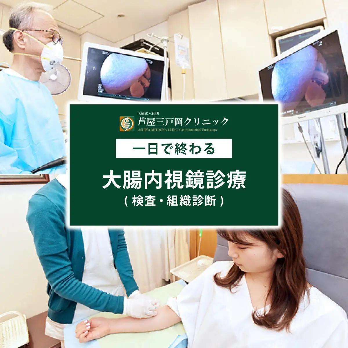 1日で終わる 大腸内視鏡診療 (日帰り) 1名様【芦屋三戸岡クリニック】消化器内視鏡専門クリニック 大腸検査 内視鏡検査 大腸がん 大腸ポリープ などの 早期発見 早期対策 早期治療 健康 カウンセリング