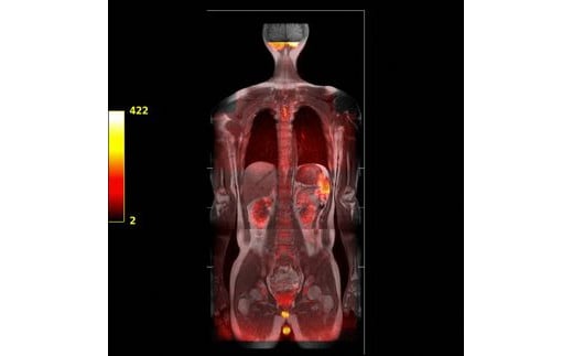 DWIBS 全身がんドック スタンダードコース 1名様1回分 | 全身 がんドック がん検診 DWIBS検査 新潟県 五泉市 医療法人社団真仁会