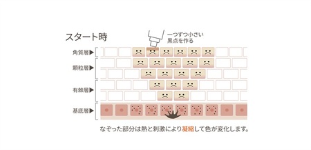 リアージュ（シミケア）30分コース 10回券 リアージュ シミケア フェイシャルコース 30分 10回券 クレンジング 角質ケア マスク ヘッドマッサージ 低周波パルス コース チケット 10回分 セ