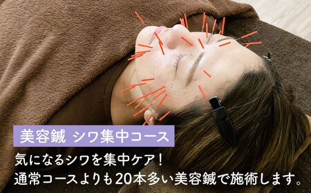 美容鍼 シワ 集中コース 60分 チケット （おひとり様/一回分） 【鍼灸院ホワイトリーフ】体験 デトックス アンチエイジング [TDZ002]