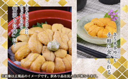 【訳あり・数量限定】北海道産 うに キタムラサキウニ 400g（100g×4パック） ミョウバン不使用