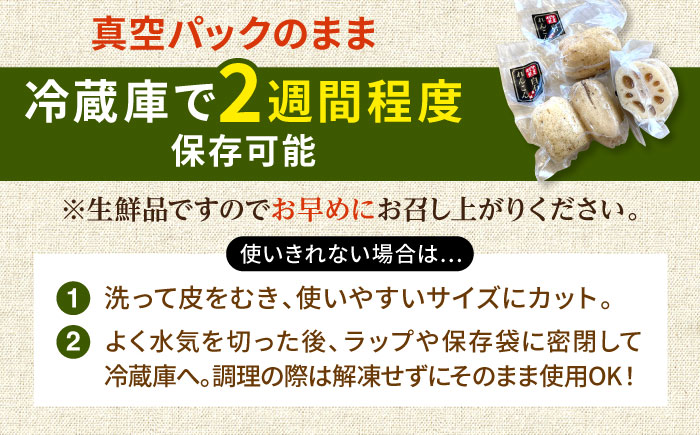 【先行予約】【真空パック】新鮮でおいしい！ 佐賀のがばいうまかレンコン 約1.5kg【有限会社白石開発】 [IBN006]