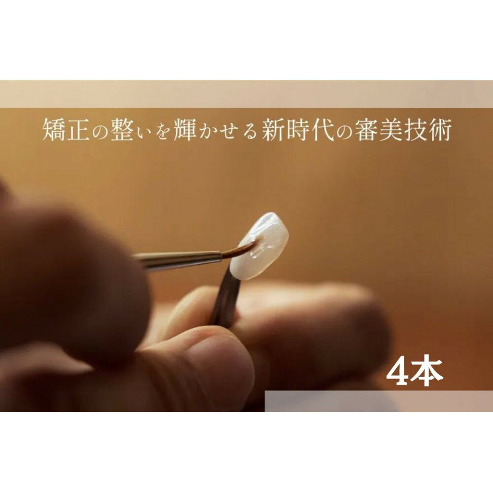 【ふるさと納税】ブラックフィルム施術券(4本)