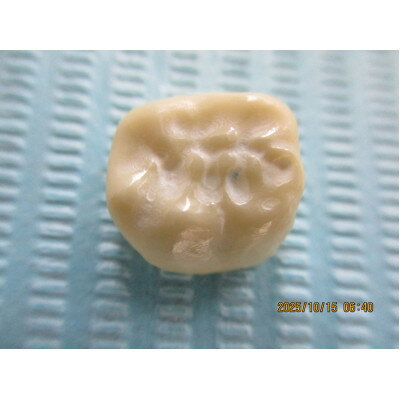 【ふるさと納税】ジルコニアの1回治療(2年無料・7年有料保証付き)【1678768】