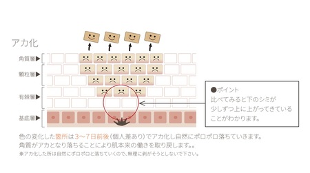 リアージュ（シミケア）30分コース 5回券 フェイシャルコース クレンジング 角質ケア マスク ヘッドマッサージ 低周波パルス チケット 5回分 セット プライベートサロン Bodycare Salo