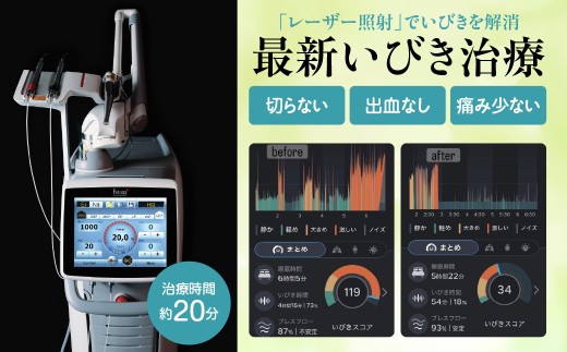 いびき治療利用券（５回） 【最新 いびき 治療 利用券 ふるさと納税 群馬県 安中市】ANBV003
