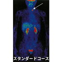 【ふるさと納税】P2 スタンダードコース　【 PET-CT 腫瘍マーカー がん検診 スクリーニング検査 血液検査 肝炎 萎縮性胃炎 感染症検査 小さながん 高い 確率 早期発見 早期治療 】