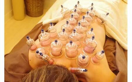 チケット 神奈川 鍼灸サロンで使えるお得なチケット 針灸 利用券 商品券 美容 鍼 肩こり 腰痛 疲労回復 ケア 藤沢市 神奈川県