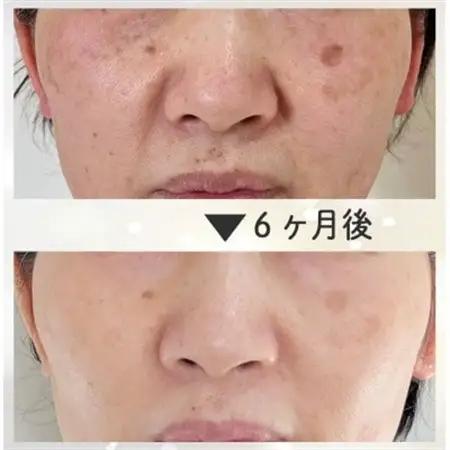 【女性限定】結果にこだわった28年の綺麗になるエステコース(フェイシャルorボディ)【1572890】