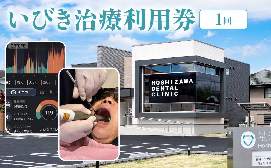いびき治療利用券（１回） ANBV001