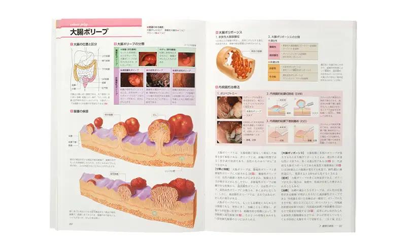 本 病気の地図帳 増補改訂版 本