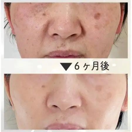 【女性限定】結果にこだわった28年の綺麗になるエステコース(フェイシャルorボディ)【1572890】