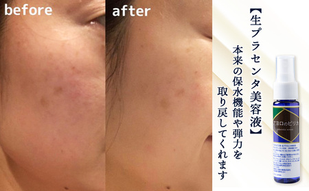 北海道白老産 生プラセンタ美容液＆北海道産 サプリメント ～アヨロのピリカ・アンケシ～