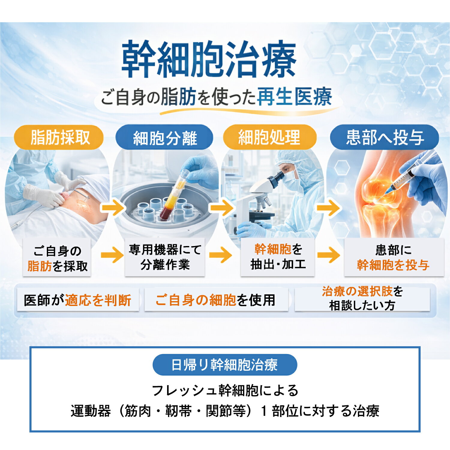 【ふるさと納税】【日帰り幹細胞治療】フレッシュ幹細胞による運動器（筋肉・靭帯・関節等）1部位に対する治療【 PRP療法 幹細胞治療 再生医療 そばじまクリニック 変形性関節症 整形外科 スポーツ整形 機能回復×生活習慣病プログラム 】