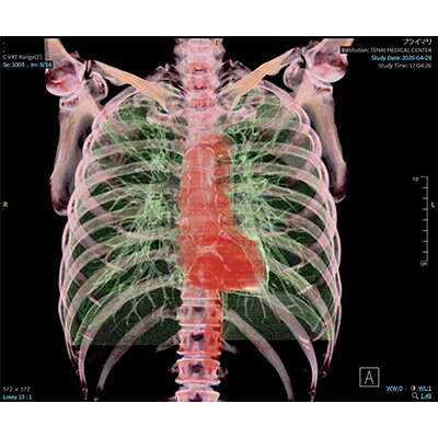 【ふるさと納税】「天理発　3D　CT　画像健診」【1737492】