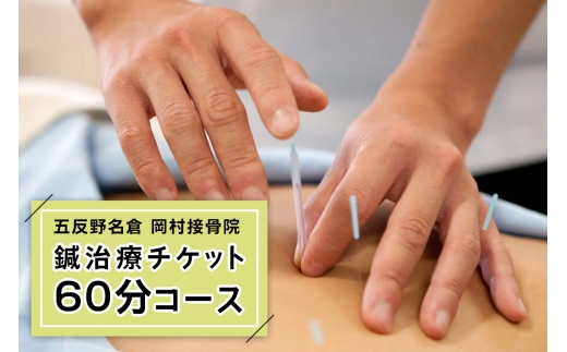 鍼治療60分コース(全身調整)チケット【五反野名倉岡村接骨院のみで使用可】｜足立区 チケット 施術 鍼 券 [1451]