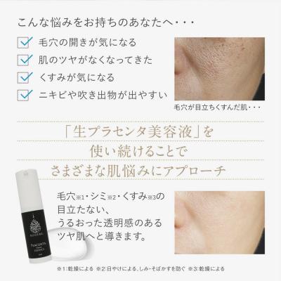 ふるさと納税 京都市 【ロゼべ】生プラセンタ 美容液 |京都 コスメ 美容液 人気 おすすめ |  | 03