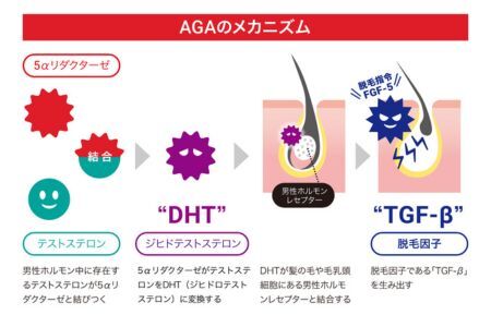 AGAによる薄毛リスクが、髪の毛数本でわかる!【毛髪ホルモン量測定キット(DHT)】