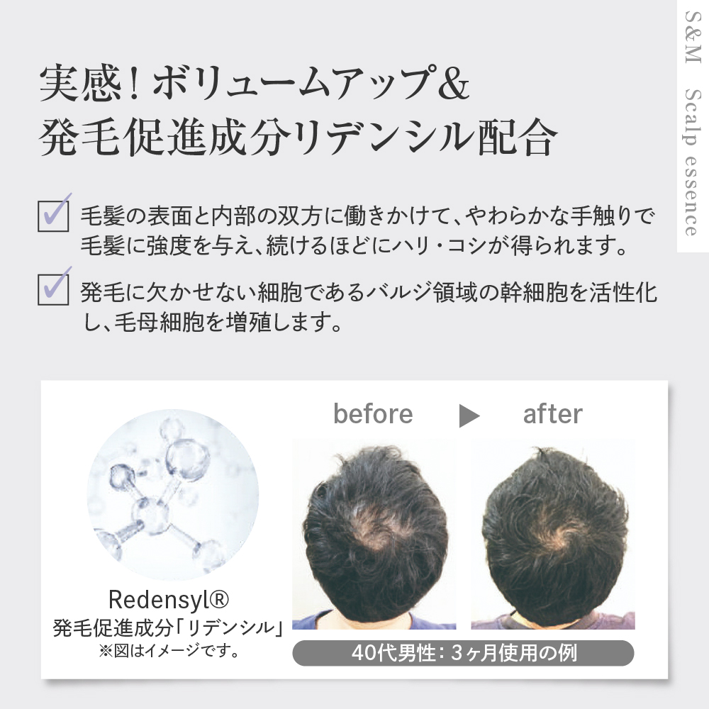 SAN＆MONI スキャルプエッセンス 300ml 群馬県 千代田町 詰め替え レフィル スカルプ エッセンス 発毛促進 育毛 薬用 送料無料