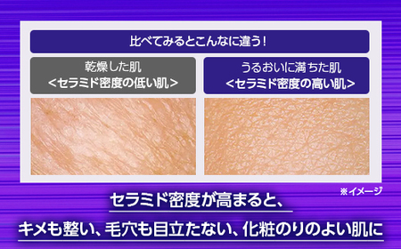 ＼最短７営業日以内発送／コーセー　ONE BY KOSE セラムヴェール ディープリペア（60ml）1本｜化粧品 コスメ KOSE ｺｰｾｰ スキンケア 美容 