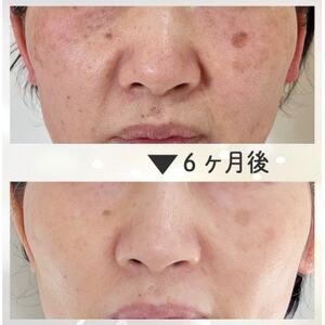 【女性限定】結果にこだわった28年の綺麗になるエステコース(フェイシャルorボディ)【1572890】