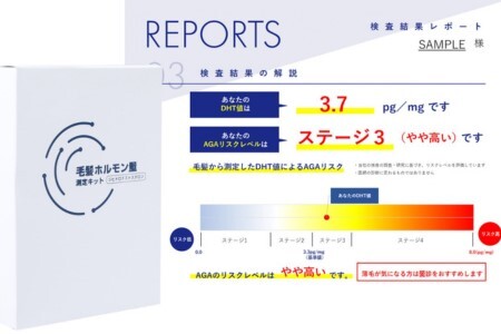 測定 AGA 薄毛リスク 髪の毛数本でわかる！【毛髪ホルモン量測定キット（DHT）】