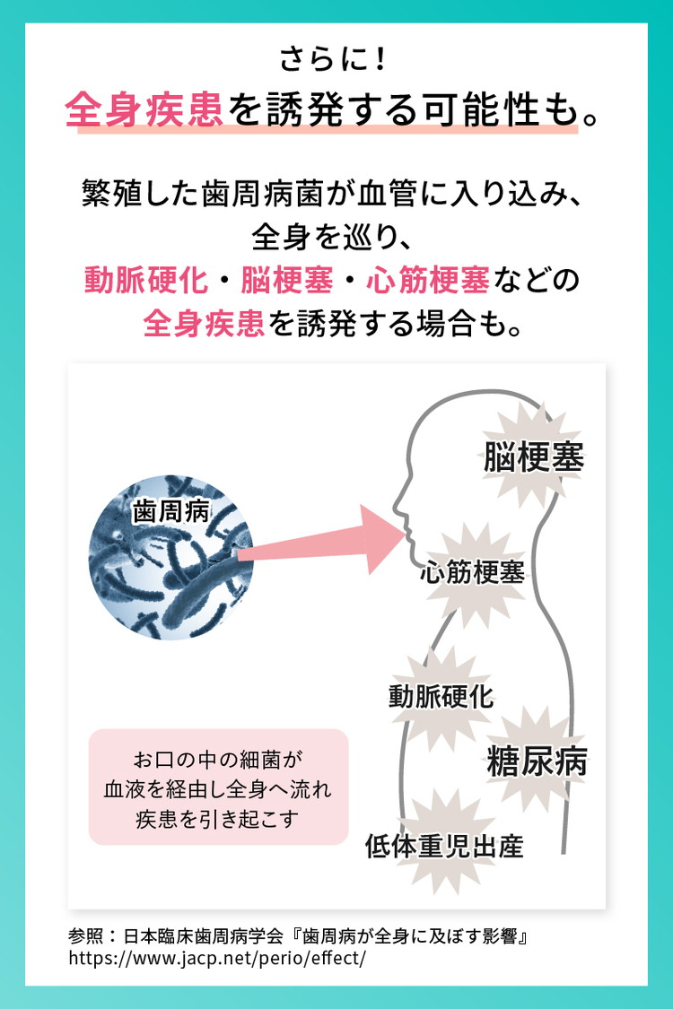 歯周病ケア 歯磨き粉 ペリオテクト シトラスミックス味 1本 ホワイトエッセンス [医薬部外品] | IPMP CPC 歯周病 歯槽膿漏 予防 対策 研磨剤なし 黄ばみ ヤニ取り 茶渋 美白 自宅 簡