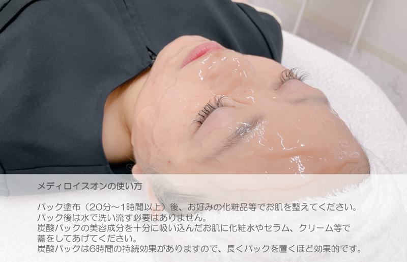 美肌科学の生炭酸パック メディロイスオン（高濃度生炭酸パック） 020C236